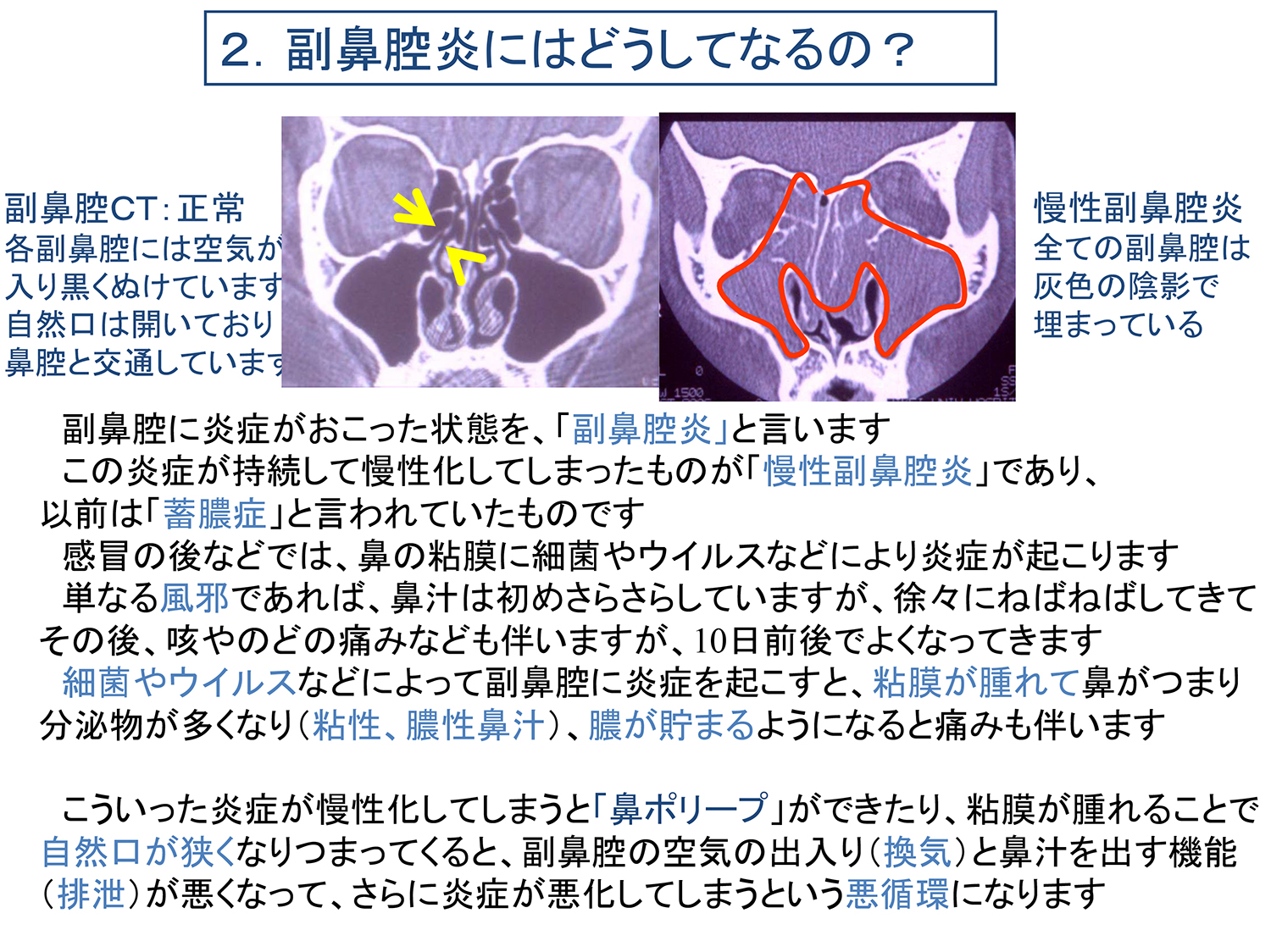 メリットは何ですか?