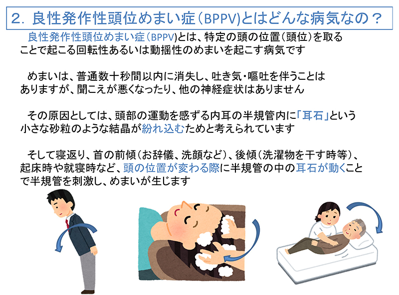 方 めまい 耳 石 治し 寝起きのめまいの原因と治し方！予防方法は三半規管に耳石を入れない