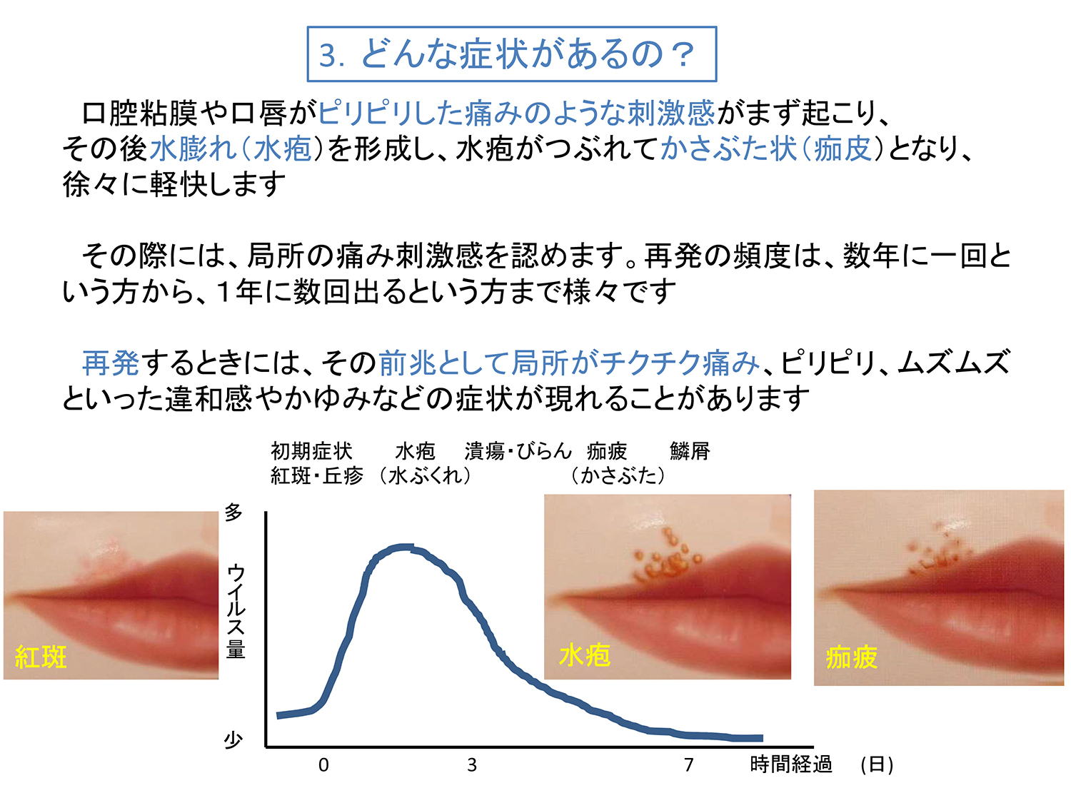 鼻 ヘルペス に なる 原因