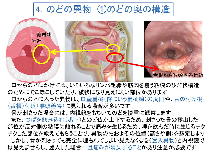 耳 に 異物