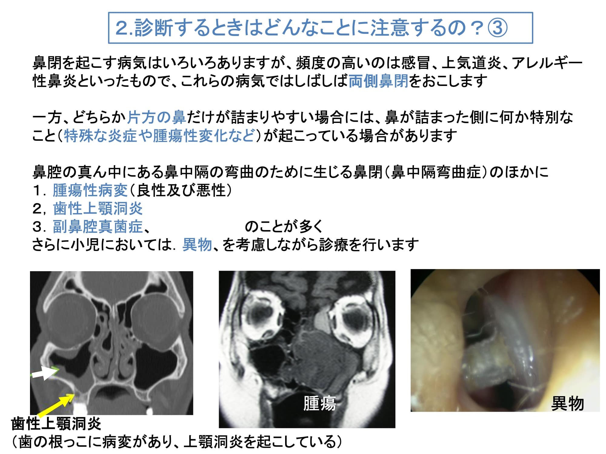 2. 診断するときはどんなことに注意するの？③