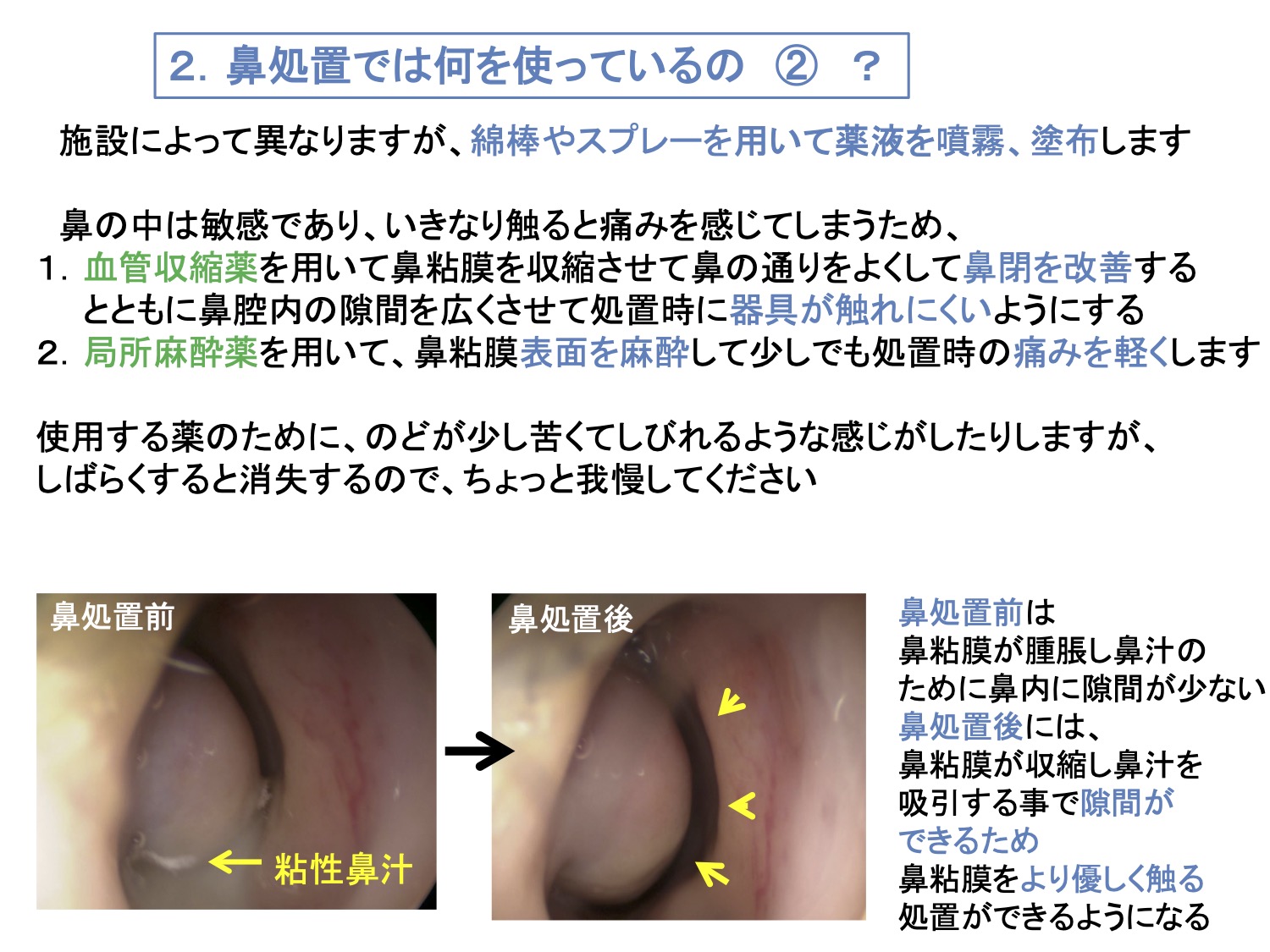 2. 鼻処置では何を使っているの②？