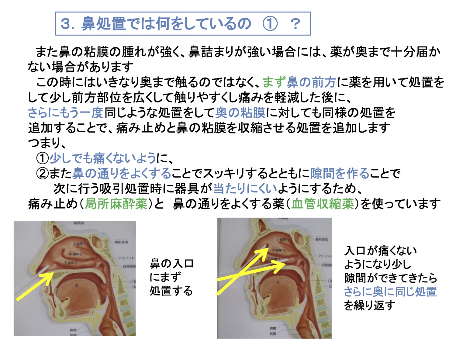 3. 鼻処置では何をしているの①？