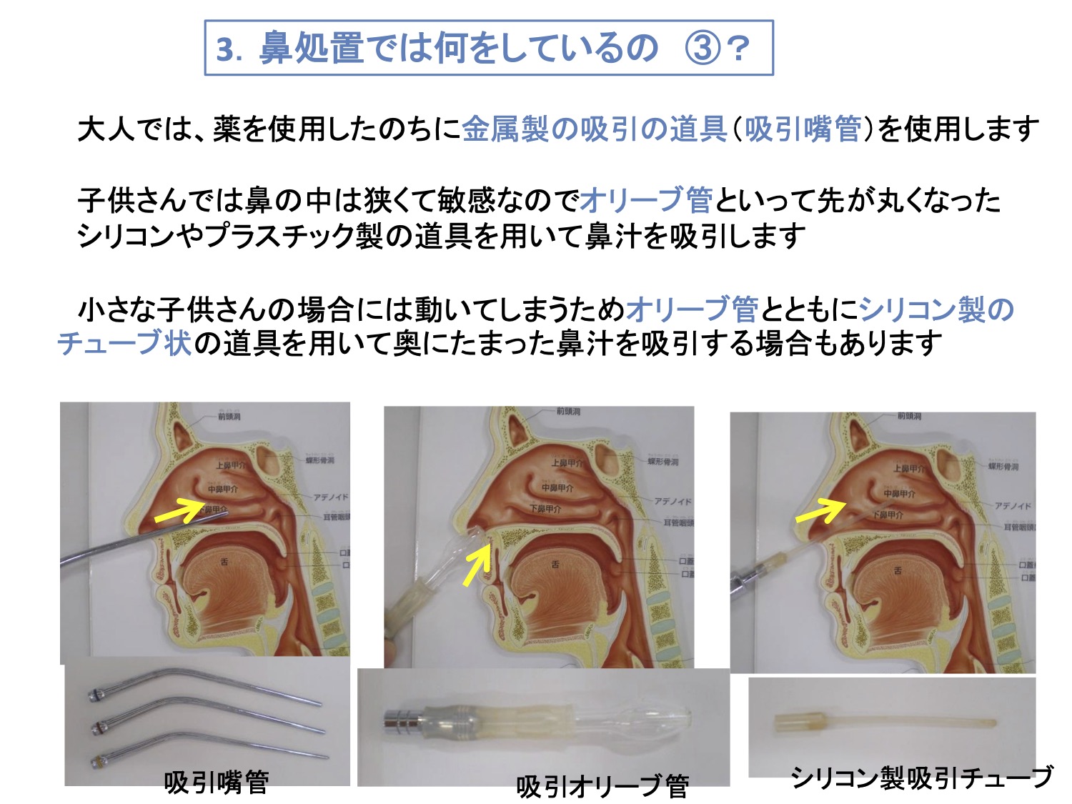 3. 鼻処置では何をしているの③？
