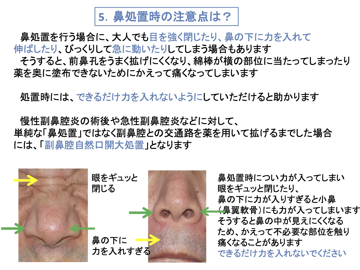 5. 鼻処置時の注意点は？