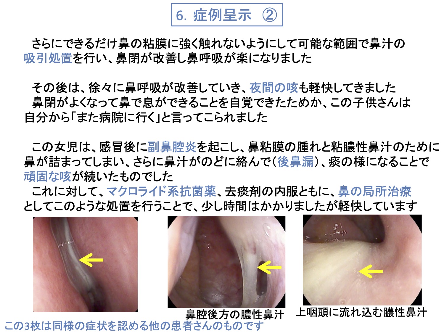 6. 症例呈示②