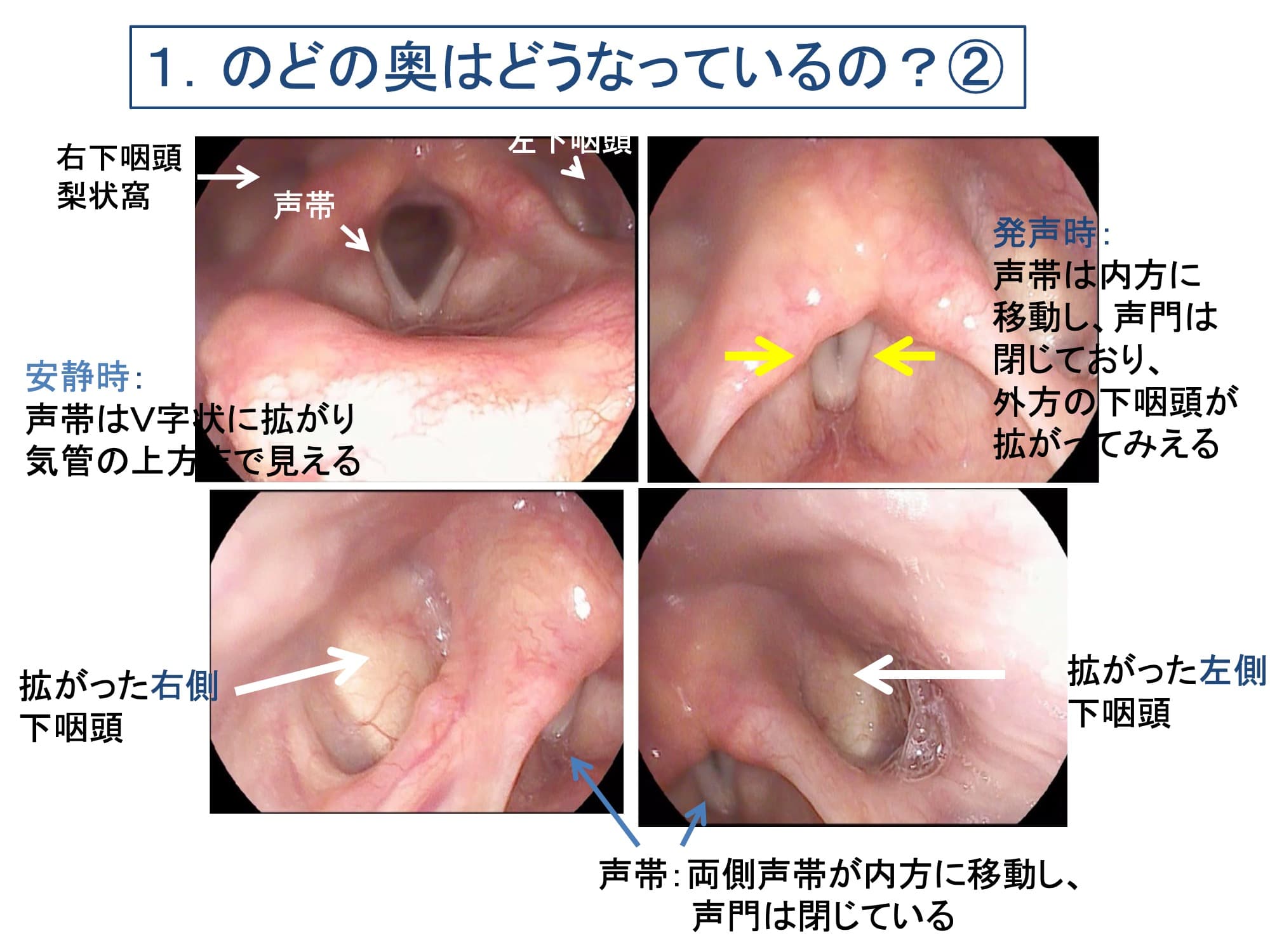 1. のどの奥はどうなっているの？②