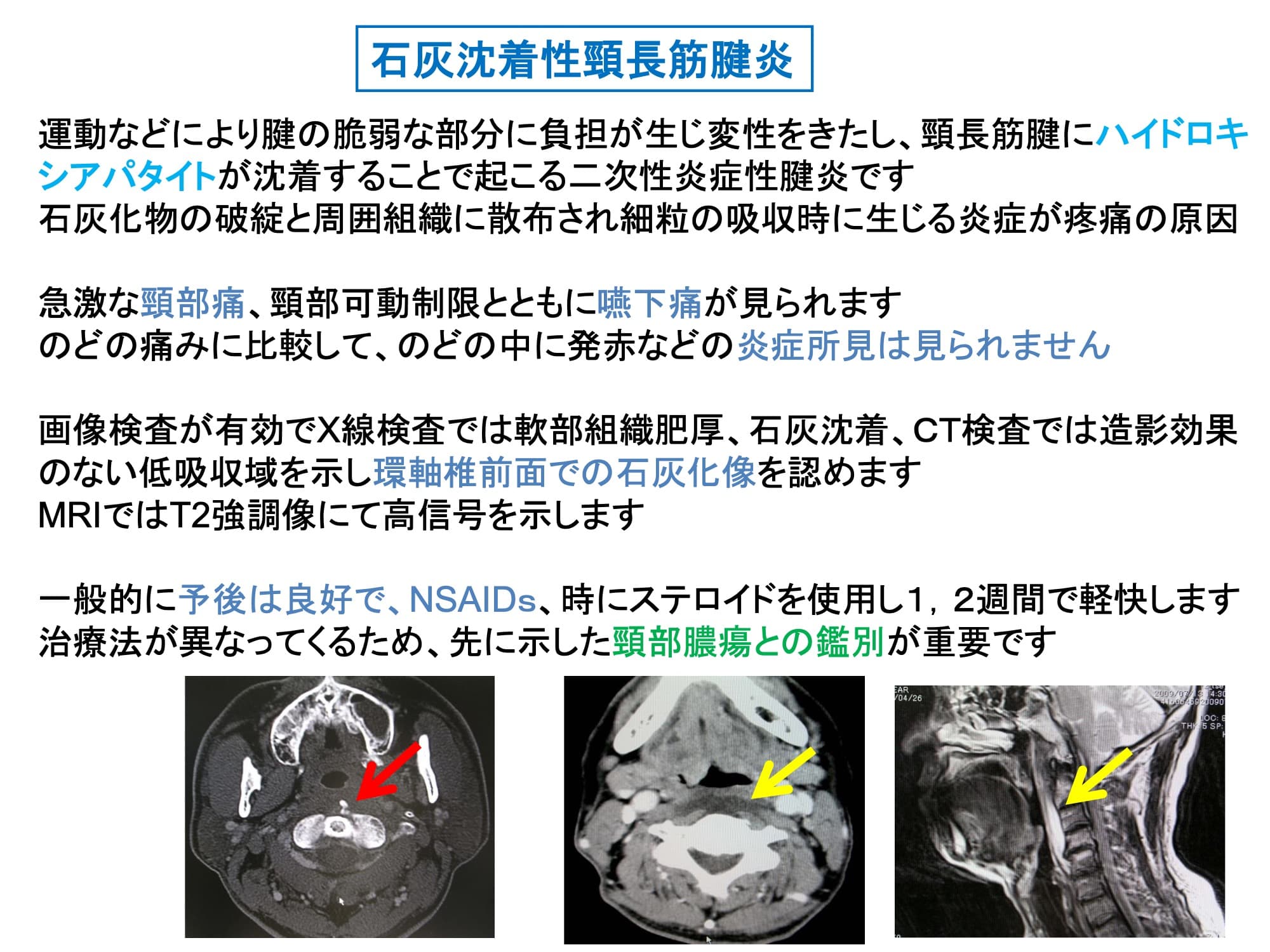 石灰沈着性頸長筋腱炎
