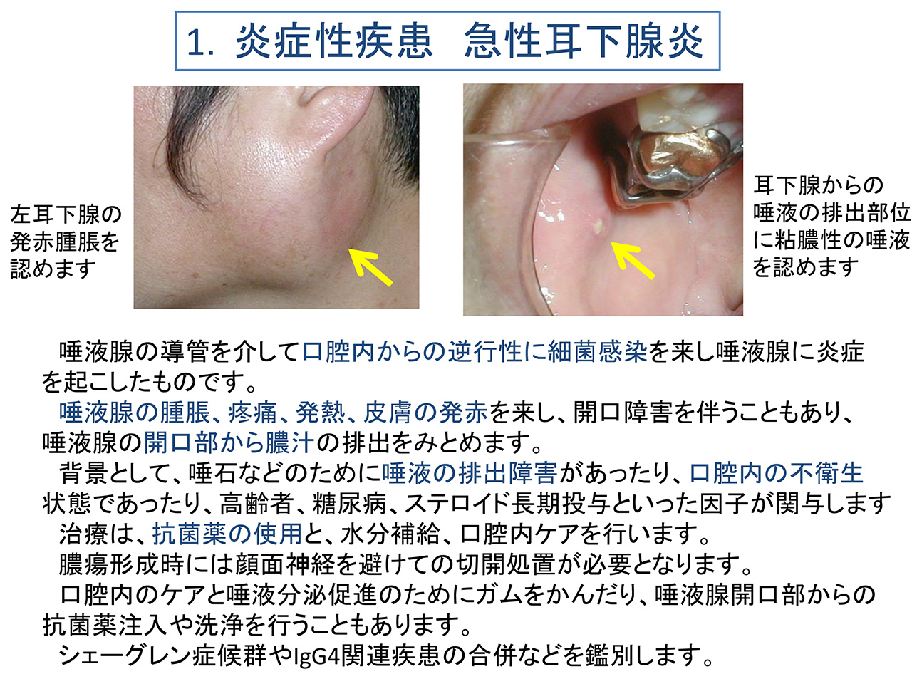 唾 が 泡 に なる 原因